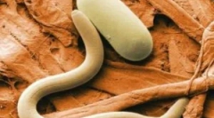 Nebezpečné parazity: kto sú takéto opistory a ako liečiť opistory